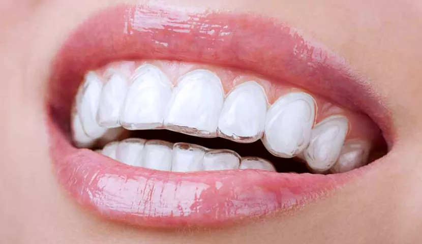 مزایای استفاده از نایت گارد
