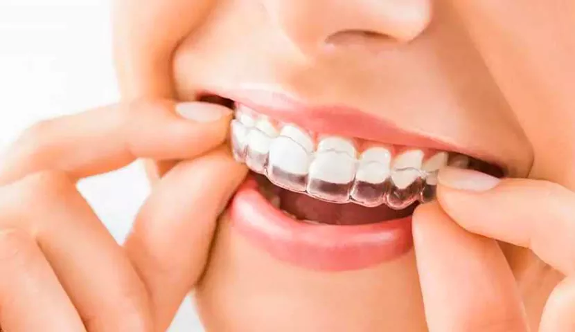 نحوه استفاده و ساخت نایت گارد