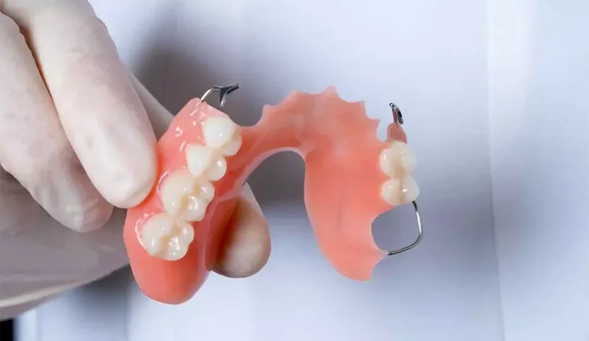 انواع فلکسبیل ها در دندان سازی
